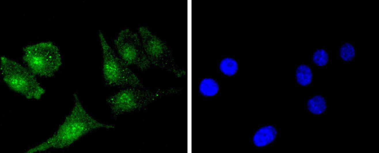 Anti-BCL2 Antibody (9S932)