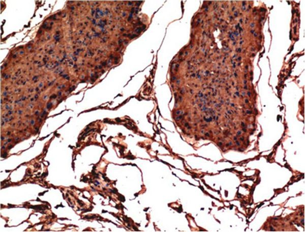 Anti-BAX Antibody (6H665)