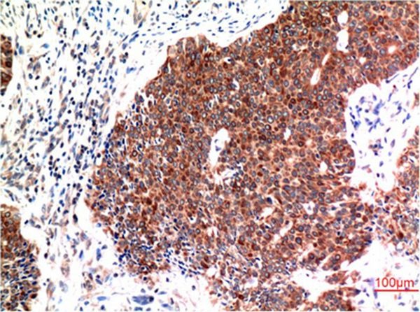 Anti-Beclin-1 Antibody (7N816)