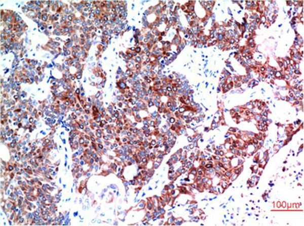 Anti-Beclin-1 Antibody (2S272)
