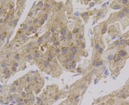 Anti-Alcohol Dehydrogenase Antibody (3W28)