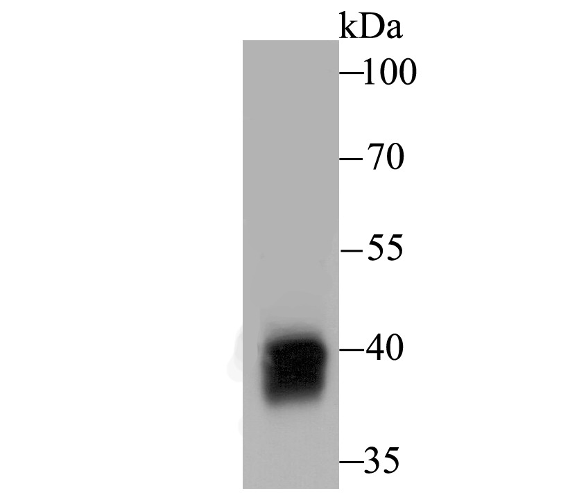 Anti-Alcohol Dehydrogenase Antibody (3W28)