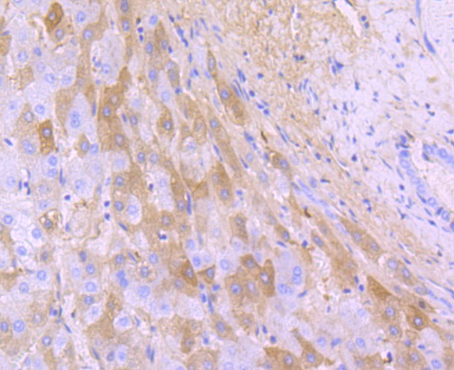 Anti-ALB Antibody (6N642)