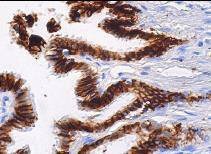 Anti-ALCAM Antibody (9Q637)