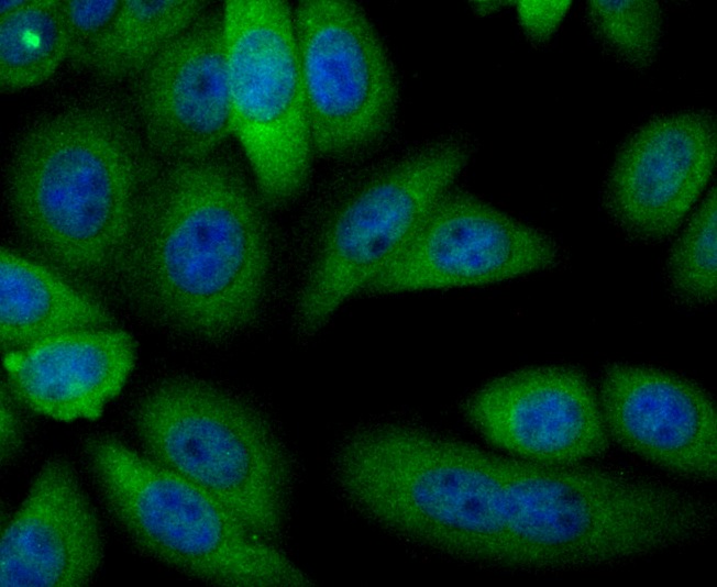 Anti-Alcohol Dehydrogenase Antibody (3W28)