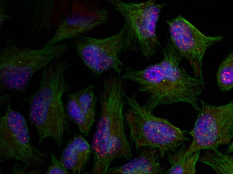 Anti-Phospho-AKT1 (Thr450) Polyclonal Antibody