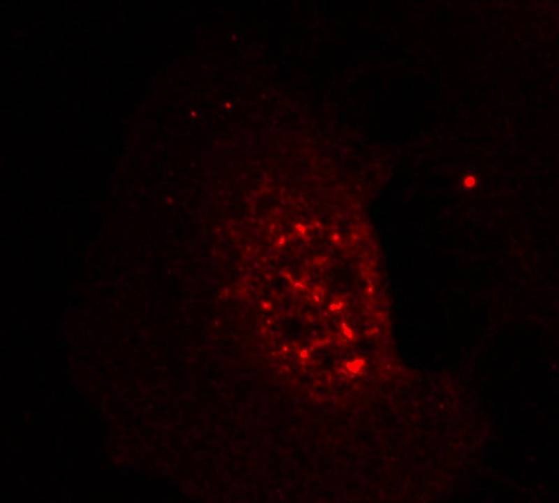 Anti-Phospho-AKT1 (Thr308) Polyclonal Antibody