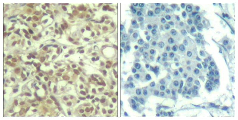 Anti-Phospho-AKT1 (Thr450) Polyclonal Antibody