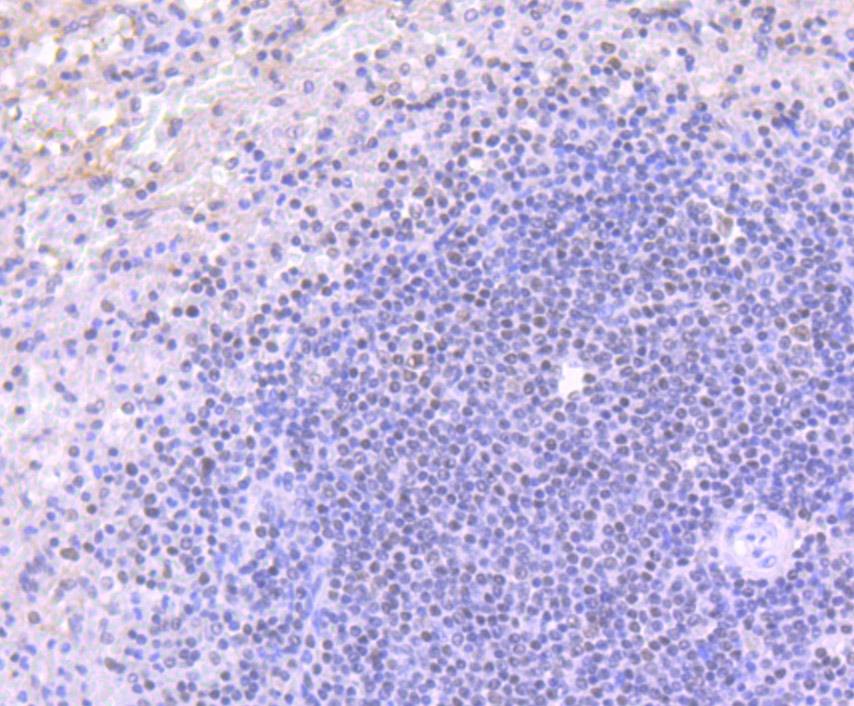 Anti-ACTL6A Antibody (7P351)