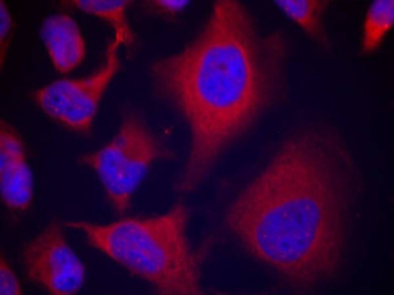 Anti-Phospho-ADD1 (Ser726) Polyclonal Antibody