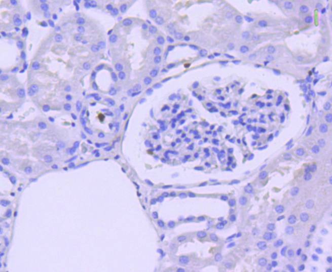 Anti-Caspase-3 Antibody (6S481)