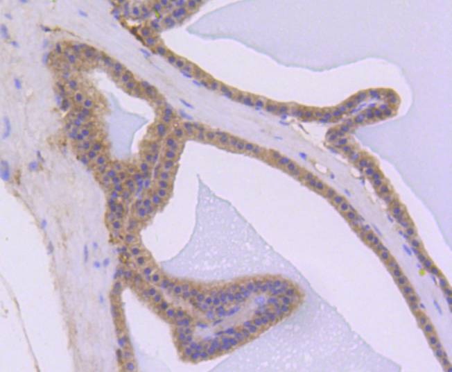 Anti-AKT1 Antibody (2R814)