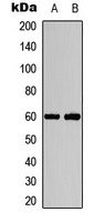 Anti-Phospho-AKT1/2 (Thr308/309) Polyclonal Antibody