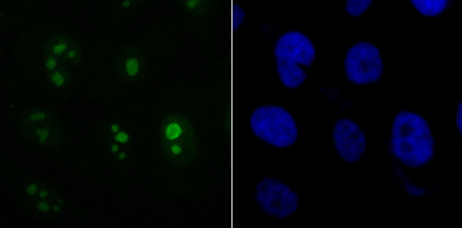 Anti-ACTL6A Antibody (7P351)