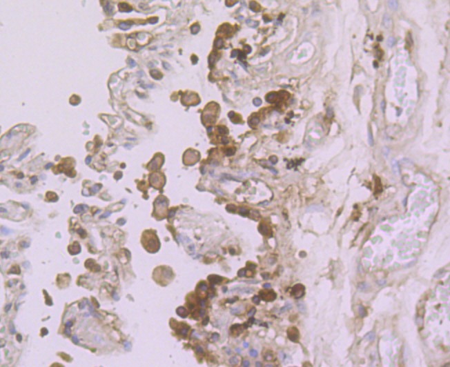 Anti-ADAR Antibody (6K725)
