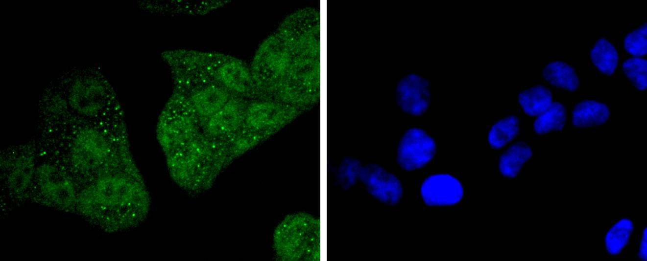 Anti-14-3-3 epsilon Antibody (5E440)