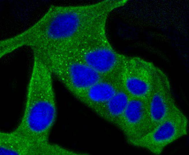 Anti-ALAS1 Antibody (7J767)