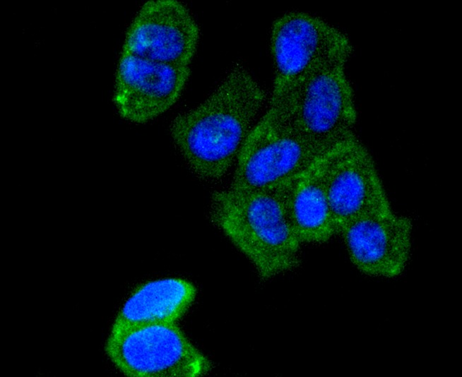 Anti-AGR2 Antibody (7E227)