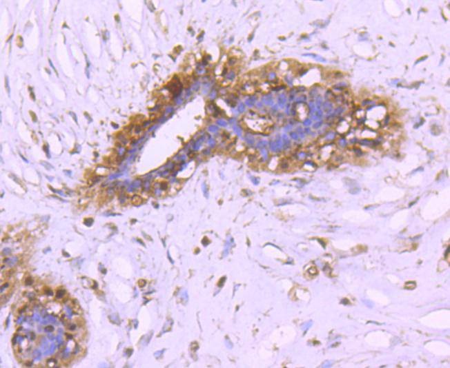 Anti-14-3-3 beta/alpha Antibody (6Z701)