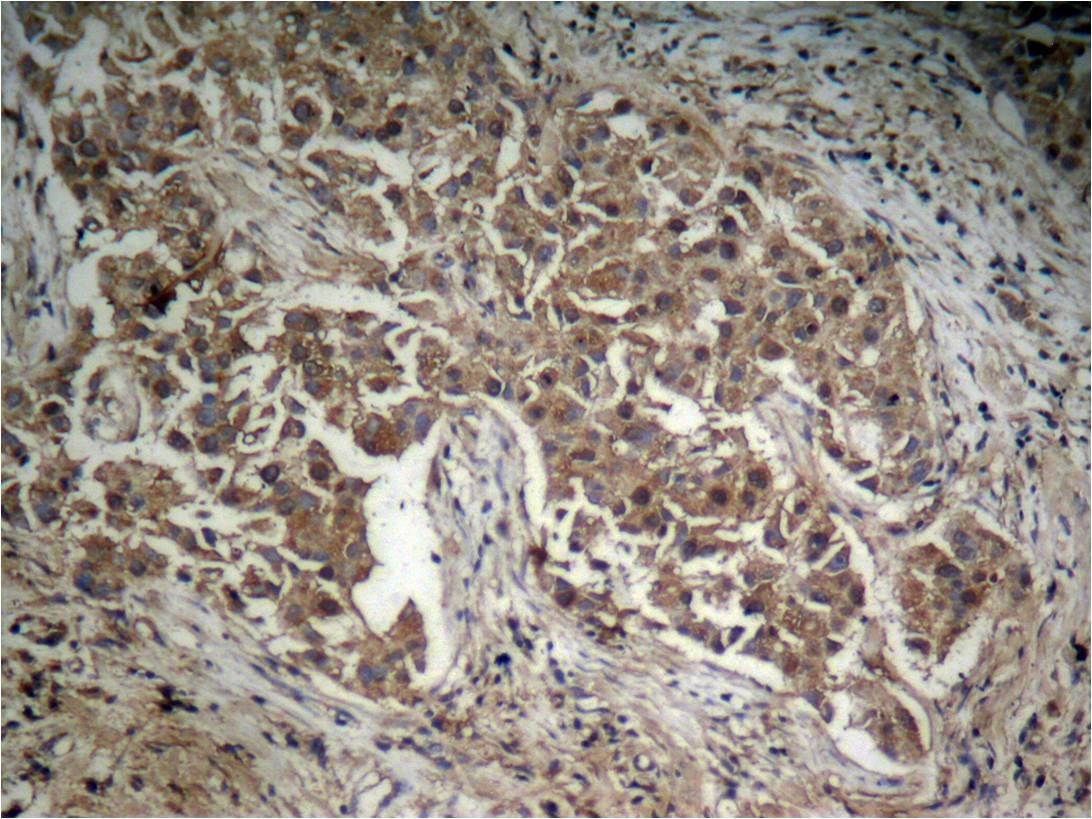 Anti-Phospho-AKT1 (Thr308) Polyclonal Antibody