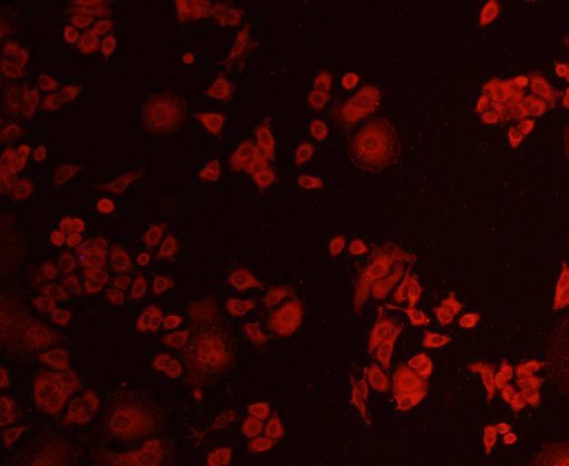 Anti-AKT1 Antibody (7N506)