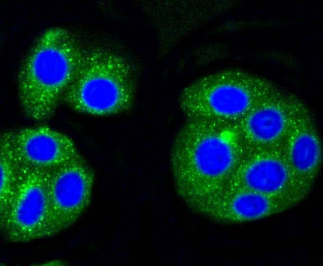 Anti-ALAS1 Antibody (7J767)
