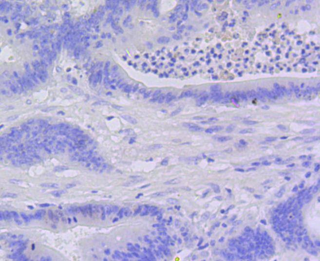 Anti-Caspase-3 Antibody (6C392)