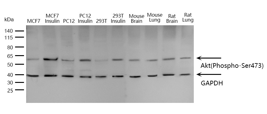 Anti-Phospho-AKT1 (Ser473) Polyclonal Antibody