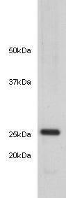 Anti-14-3-3 beta/alpha Antibody (7Q362)