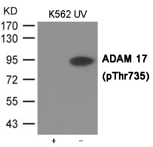Anti-Phospho-ADAM17 (Thr735) Polyclonal Antibody 2