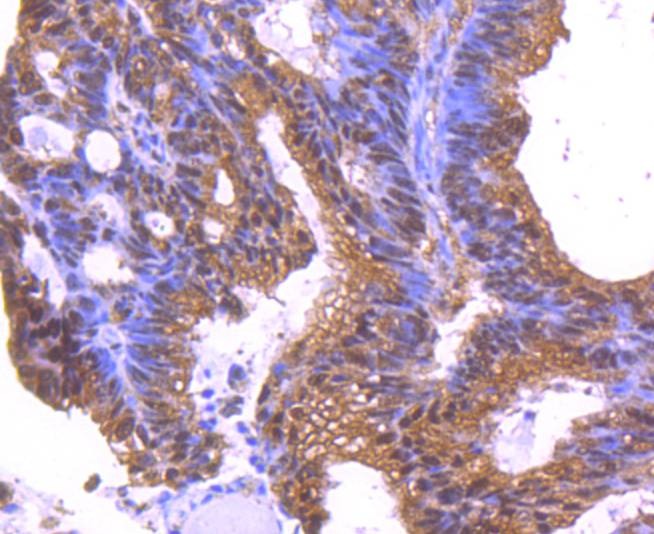 Anti-14-3-3 epsilon Antibody (5E440)