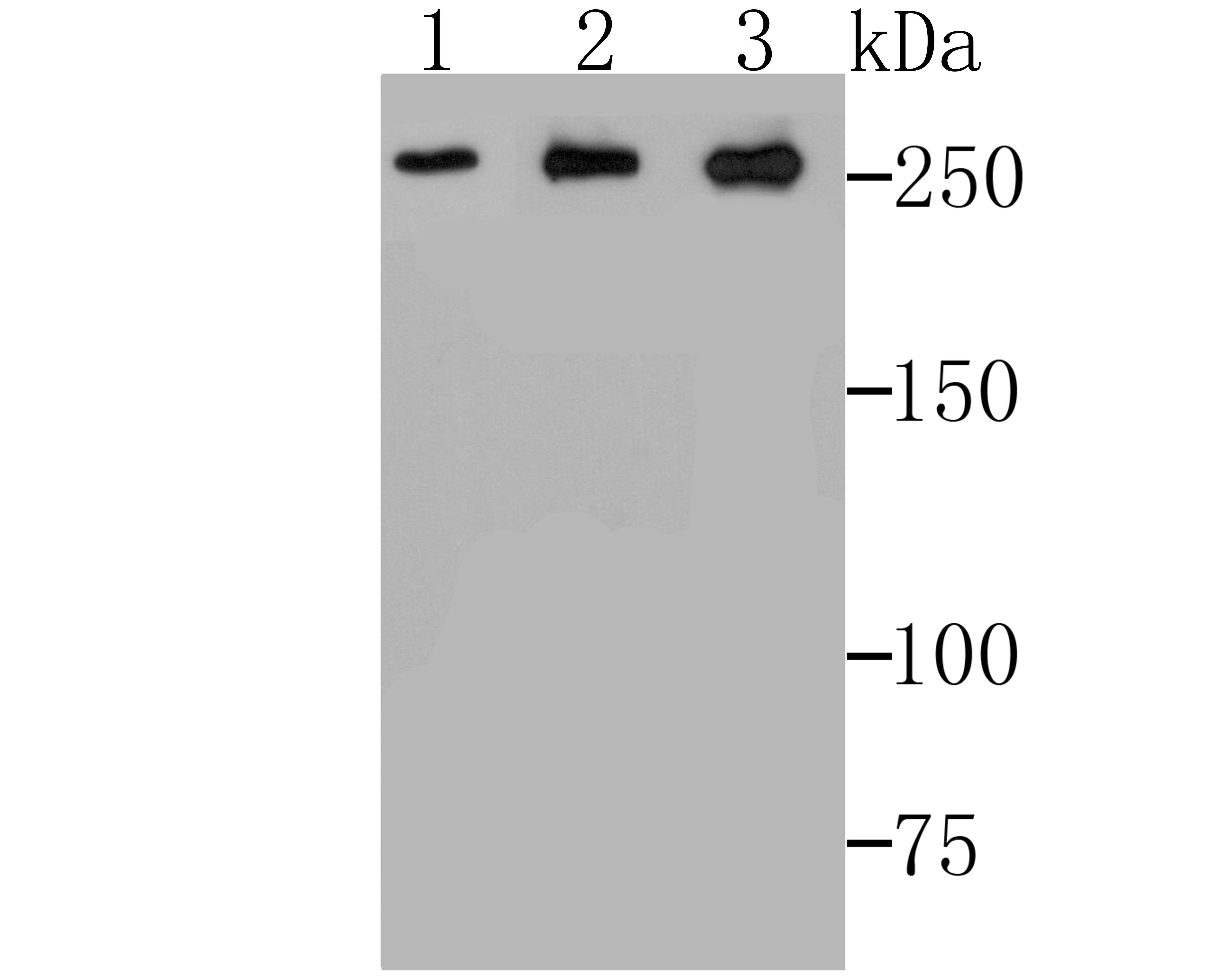 Anti-ADAMTS13 Antibody (1C436)