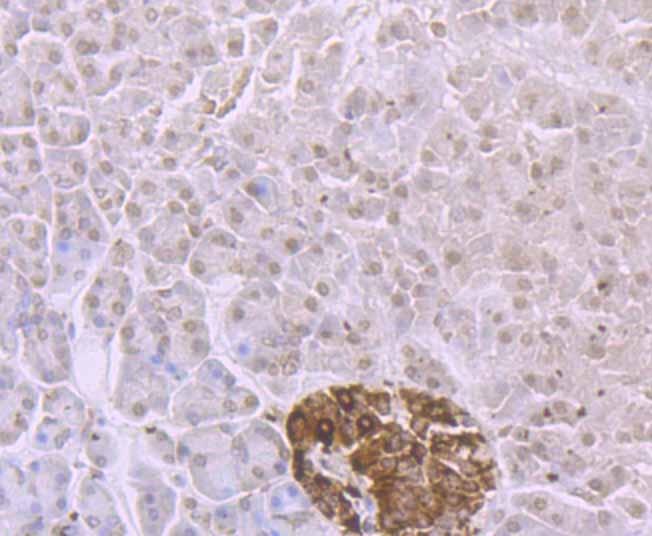 Anti-ADAR Antibody (6K725)