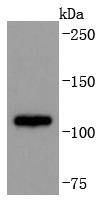 Anti-ADAM17 Antibody (6O847)