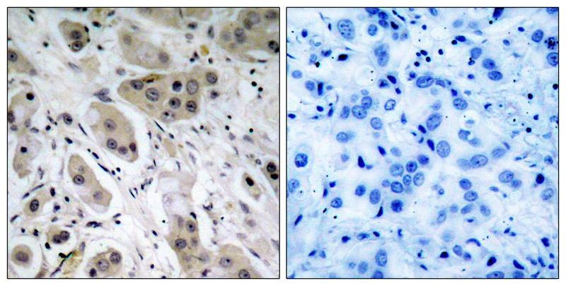 Anti-Phospho-AKT1 (Ser473) Polyclonal Antibody