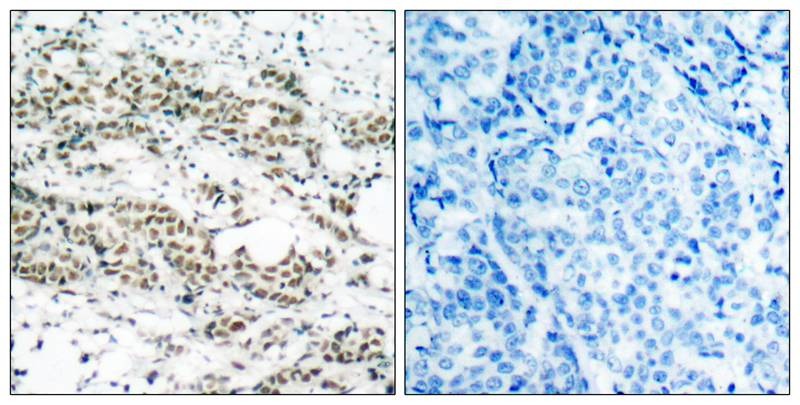 Anti-Phospho-FOXO4 (Ser197) Polyclonal Antibody 2