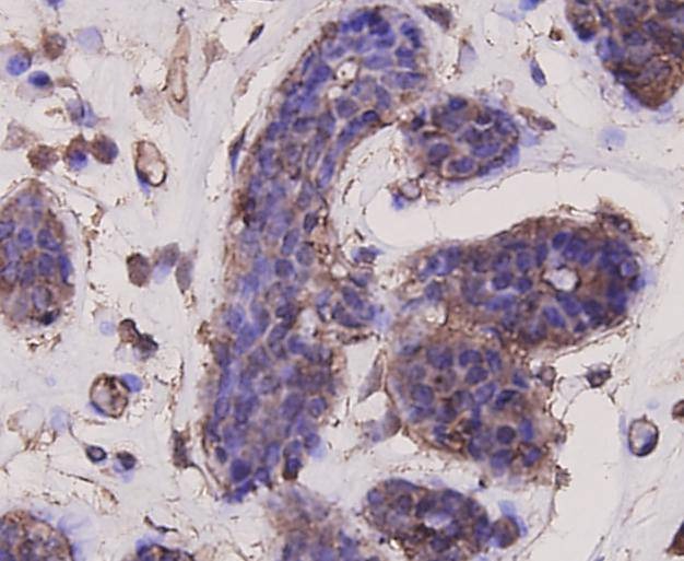Anti-AKT1 Antibody (7N506)