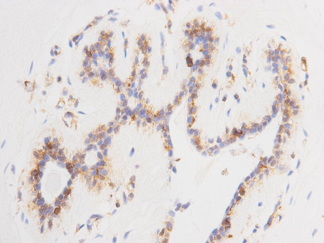 Anti-14-3-3 beta/alpha Antibody (7Q362)