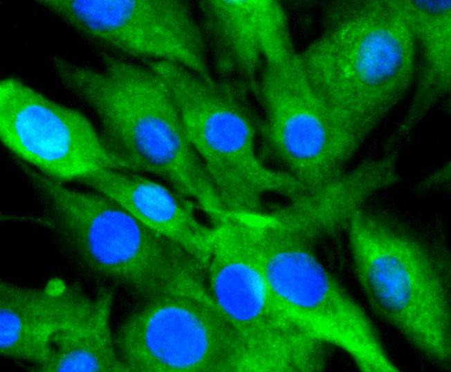 Anti-14-3-3 beta/alpha Antibody (6Z701)