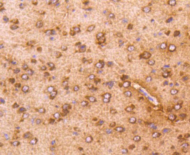 Anti-AKT1 Antibody (2R814)