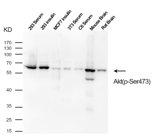 Anti-Phospho-AKT1 (Ser473) Polyclonal Antibody