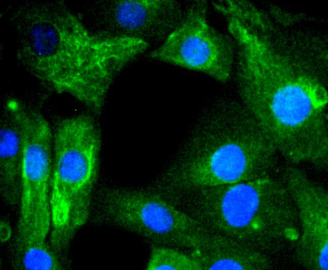 Anti-AGR2 Antibody (7E227)