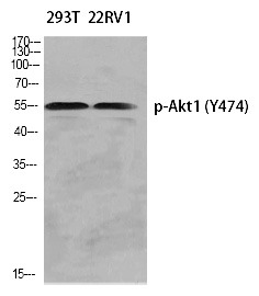 Anti-Phospho-AKT1 (Tyr474) Polyclonal Antibody
