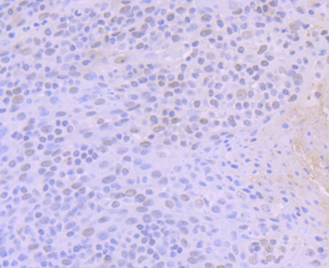 Anti-ACTL6A Antibody (7P351)