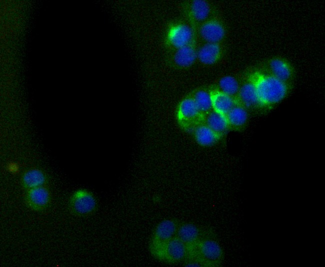Anti-alpha Internexin Antibody (3U304)