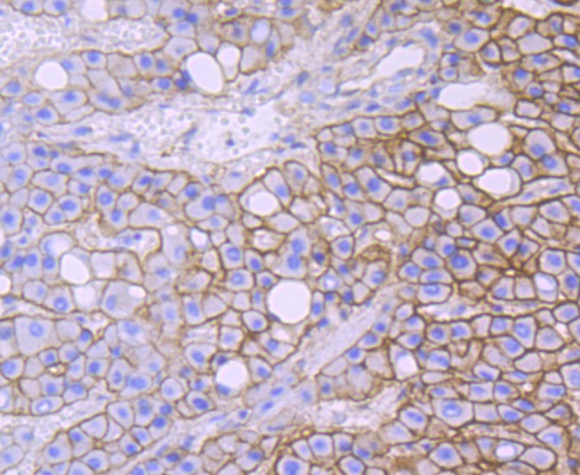 Anti-SPTAN1 Antibody (8O990)