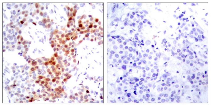 Anti-Phospho-ATF2 (Thr69 or 51) Polyclonal Antibody