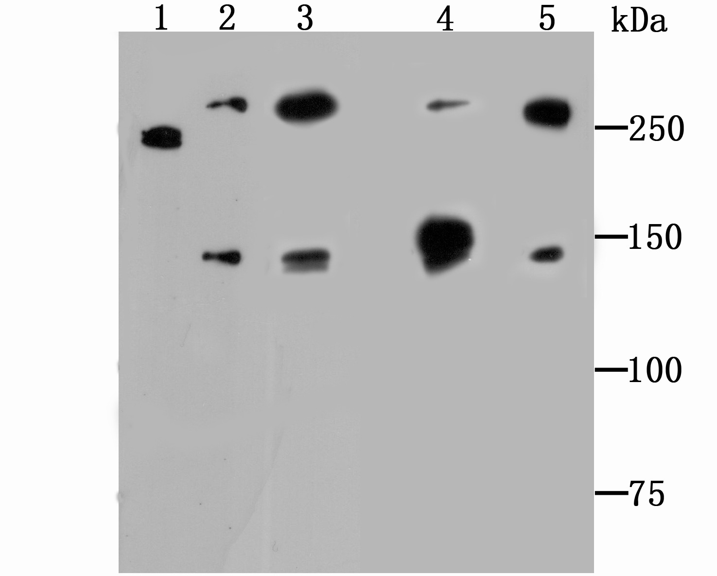 Anti-SPTAN1 Antibody (8O990)