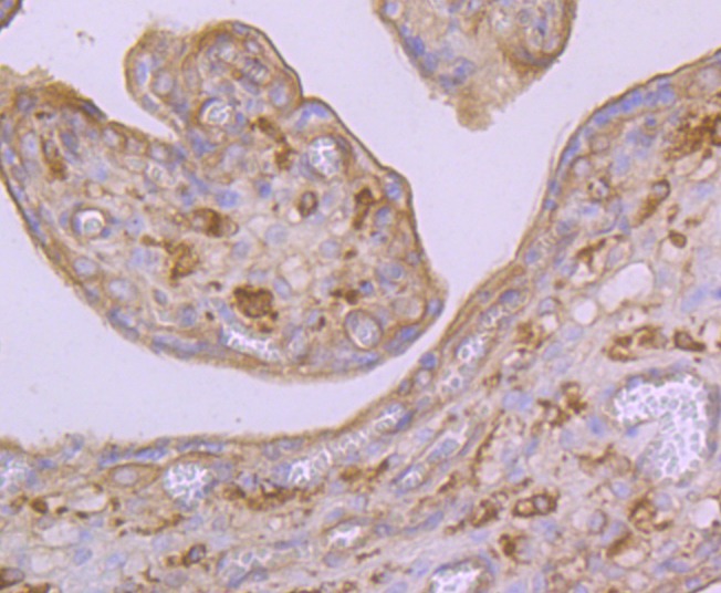 Anti-Arp3/ACTR3 Antibody (1Q436)