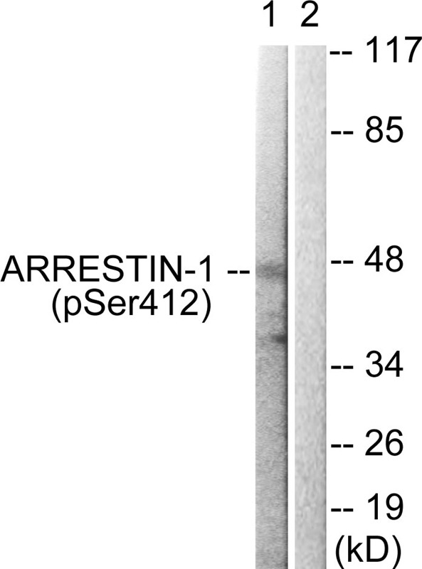 Anti-Phospho-ARRB1 (Ser412) Polyclonal Antibody